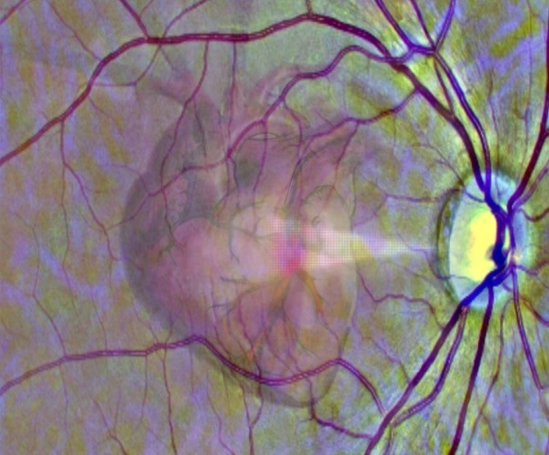 retinal scans
