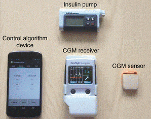 The various components of the artificial pancreas sytem
