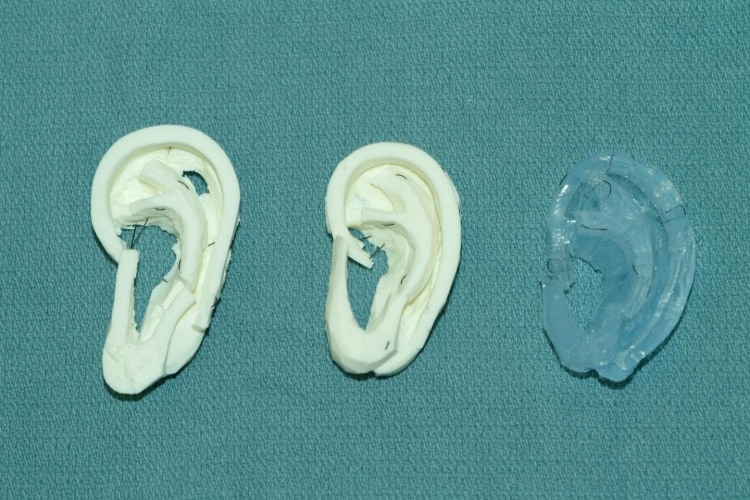 In the study, experienced surgeons preferred carving the UW's models (in white) over a more expensive material made of dental impression material (in blue).