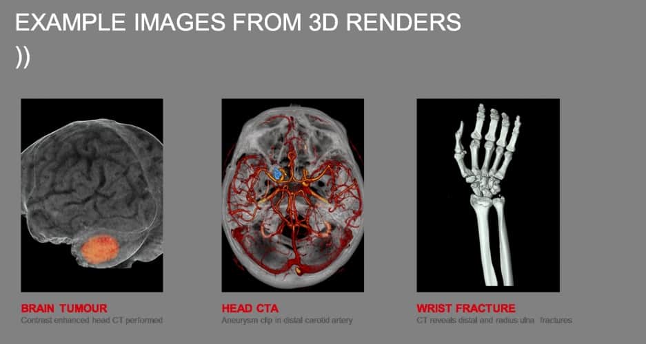 /r/h/u/Toshiba_Medical_Visualisation_Systems_scans.jpg