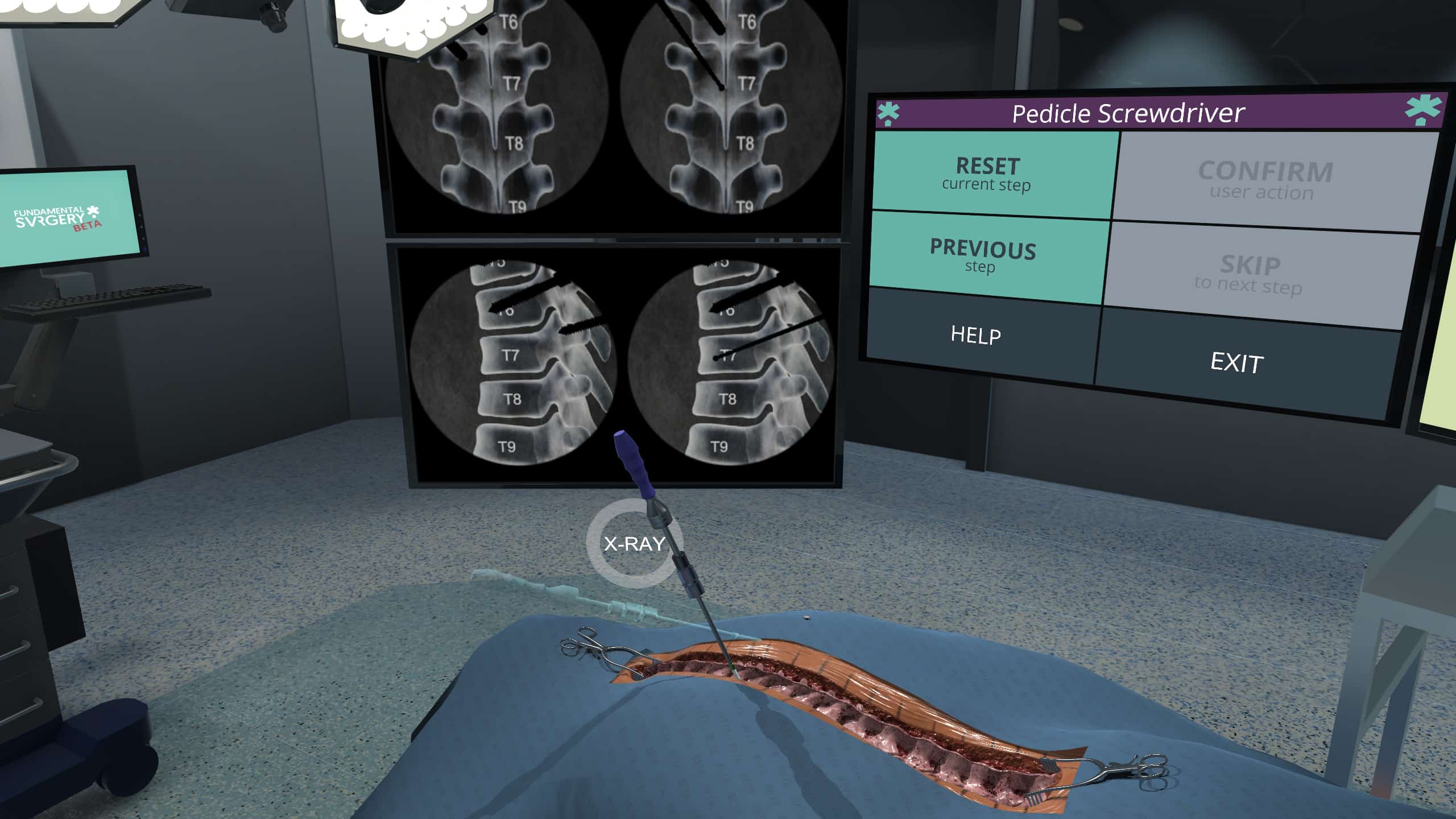 surgery simulation