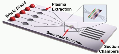 The new device uses an internal vacuum to channel the blood sample