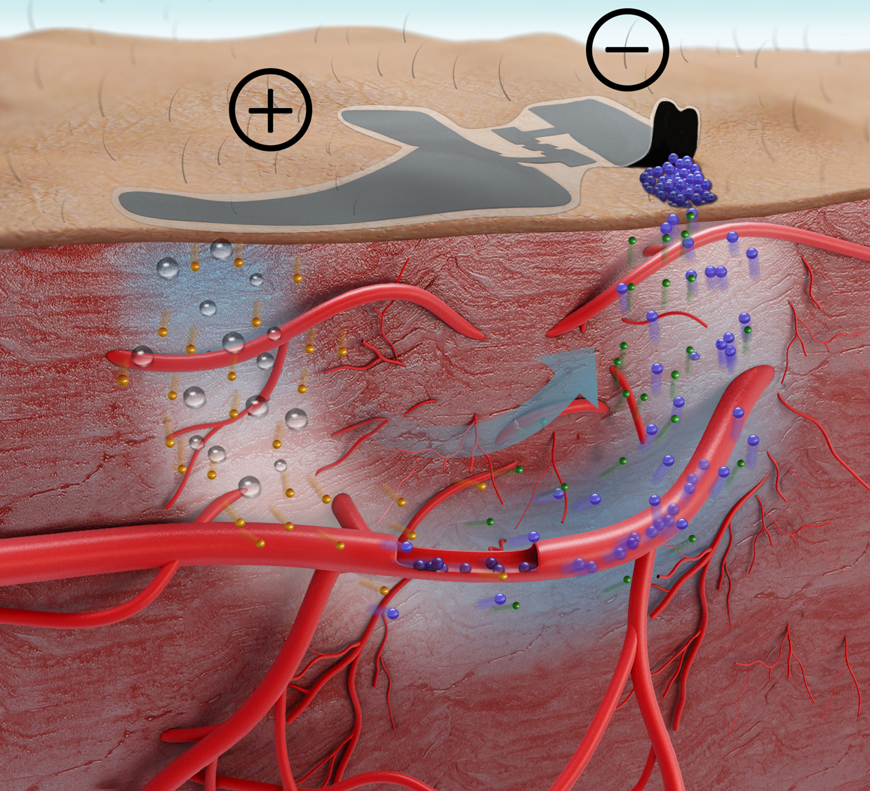 blood glucose