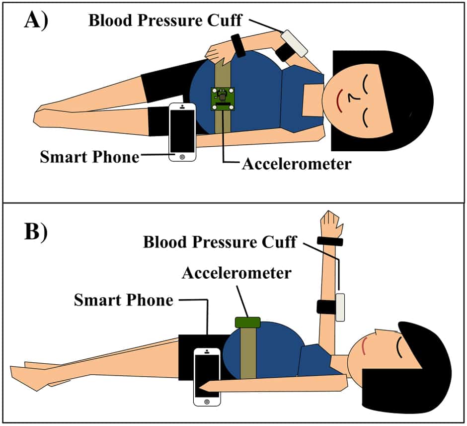 preeclampsia