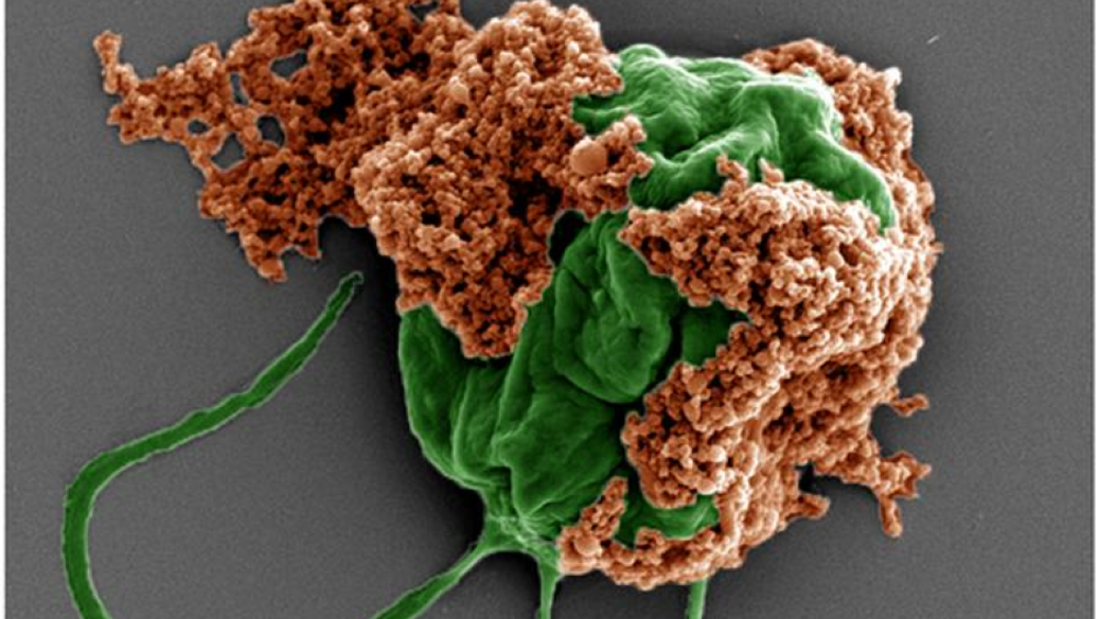 Coloured SEM image of a microrobot made of an algae cell (green) covered with drug-filled nanoparticles (orange) coated with red blood cell membranes. Scale bar: 2 µm