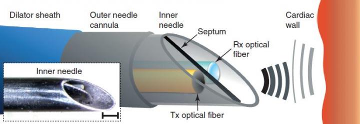 optical ultrasound