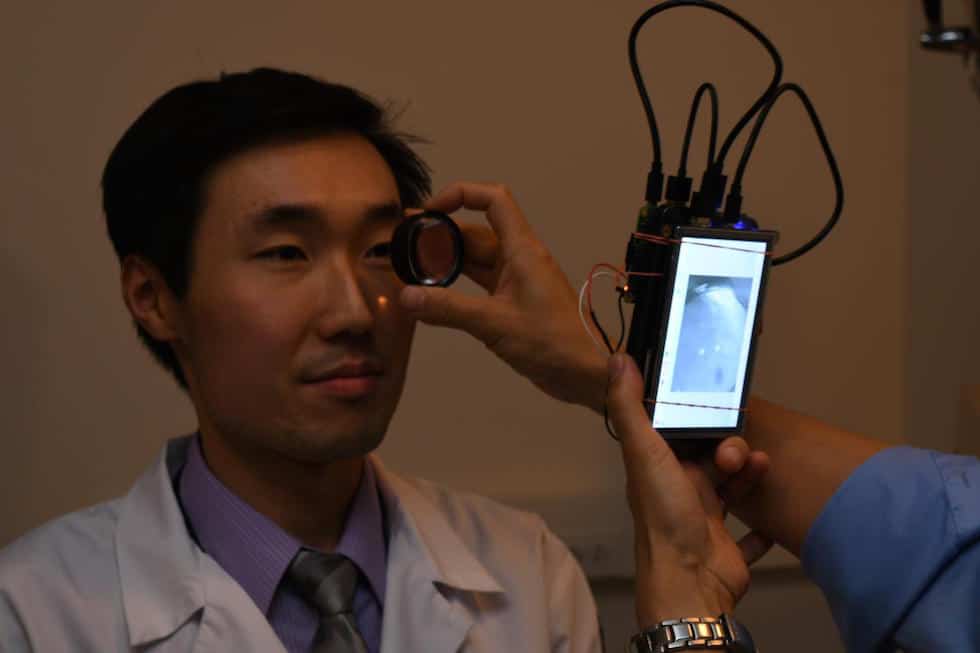 Dr Bailey Shen has his retina photographed using a camera based in the Raspberry Pi 2 computer
