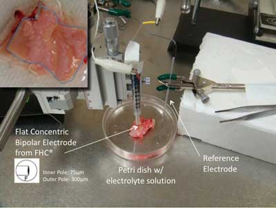 The probe seen scans plaque samples (upper left) and can distinguish stable and unstable versions. It could theoretically go into an angiogram catheter.