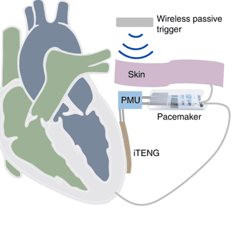 pacemaker