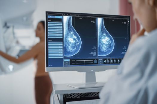 Breast cancer is the most common type of cancer in women