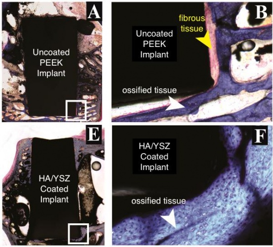 Histological evaluation of bone growth against non-coated PEEK implants (Credit: Afsaneh Rabiei)