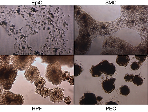 This composite shows 3-D cultures of four types of cells that Rice University scientists combined in vitro to create bronchiole lung tissue. The cells are: epithelial cells (EpiC), smooth muscle cells (SMC), pulmonary fibroblasts (HPF) and pulmonary endot