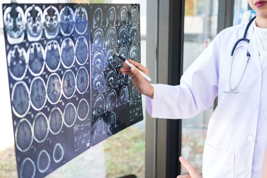 Over one million Americans have aphasia 