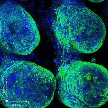Confocal microscope image of caco-2 cells on collagen scaffold, after staining for actin (green) and nucleic acid (blue)