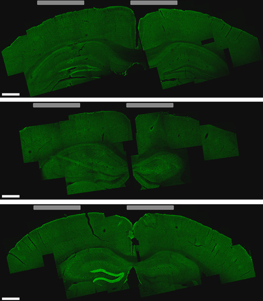 Brain slice shows hippocampus cells activated by the new stimulation technique (bottom image, lighter green areas on the left)