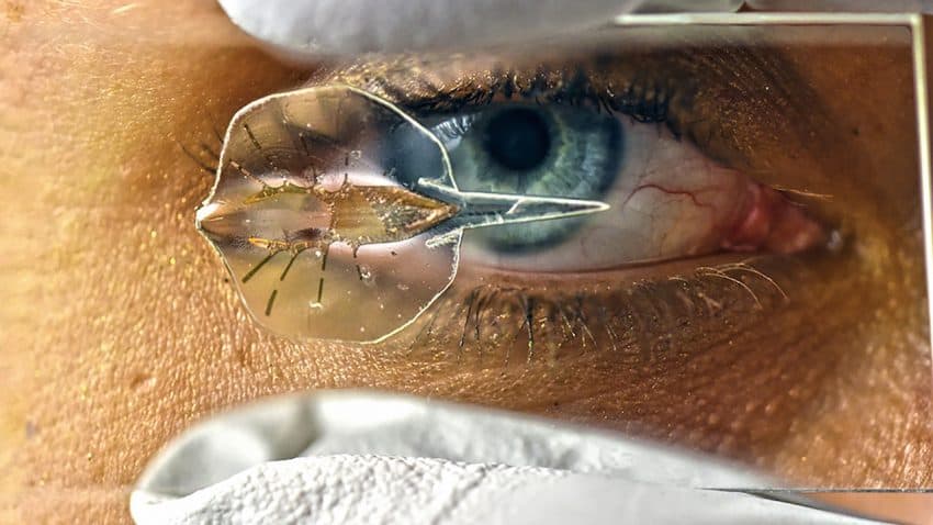 The biomechanical stingray, on a glass slide. Image Science/Karaghen Hudson & Michael Rosnach