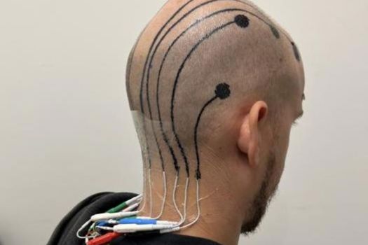 EEG setup with e-tattoo electrodes