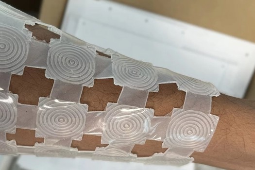The initial prototype of the STEPS1.0 technology worn on an arm