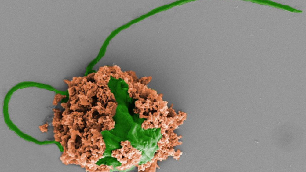 Colored SEM image of a pneumonia-fighting microrobot made of an algae cell (green) covered with biodegradable polymer nanoparticles (brown). The nanoparticles contain antibiotics and are coated with neutrophil cell membranes