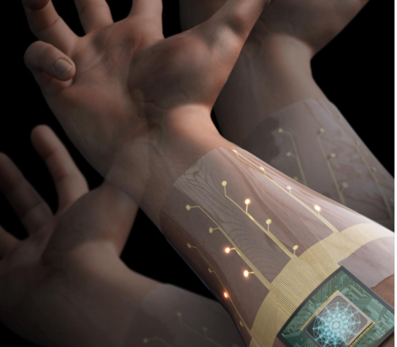 biosensor armband