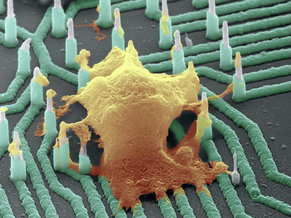 A neuron (orange) interfaced with the nanowire array (Credit: Integrated Electronics and Biointerfaces Laboratory, UC San Diego)