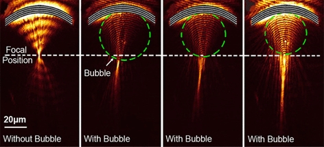 A nanoscale light beam modulated by short electromagnetic waves, known as surface plasmon polaritons -- labelled as SPP beam -- enters the bubble lens, officially known as a reconfigurable plasmofluidic lens. The bubble controls the light waves, while the