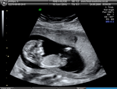 ultrasound images