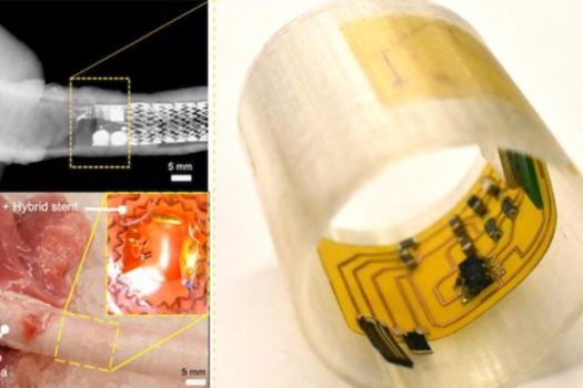 A system of artificial cilia capable of monitoring mucus conditions in human airways to better detect infection, airway obstruction, or the severity of diseases like cystic fibrosis, chronic obstructive pulmonary diseases, and lung cancer