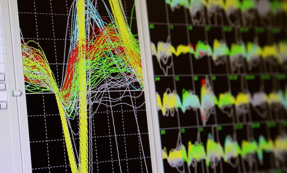 monkey brainwaves