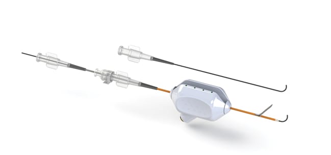 Stent Tek's minimally invasive vascular access catheter system