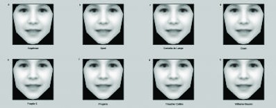 This image shows an average face taking on the average facial features of eight rare genetic disorders that have been built from a growing bank of photographs of people diagnosed with different syndromes. Oxford University scientists have developed a comp