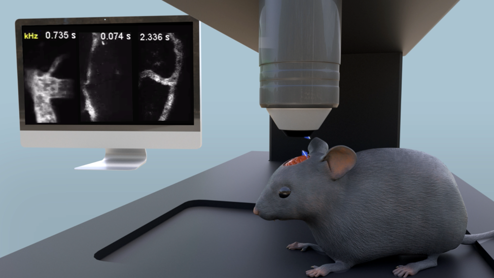 Illustration of cerebral blood flow imaging of awake mouse using the FACED (free-space angular chirp enhanced delay) microscope
