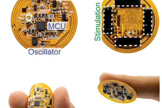 Photographs of the smart bandage showing the microcontroller unit (MCU), crystal oscillator, high-pass filter (HPF), stimulation and sensing electrodes, flexibility of the printed circuit board, adhesion of the hydrogel interface to skin, and thin layout of the board