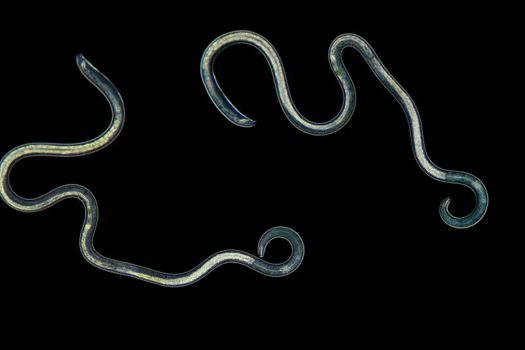 Nematodes can jump up to 20 times their body length