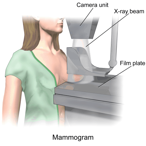 mammogram