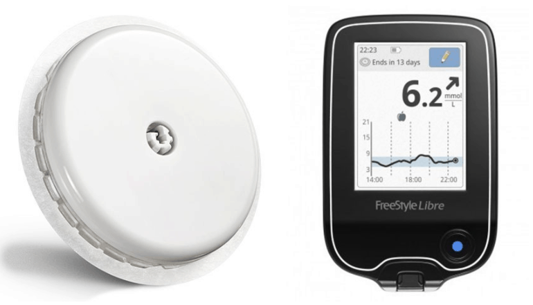 Glucose monitor