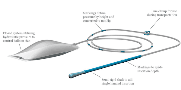 A low-cost device designed to prevent deaths from Postpartum Haemorrhage has been developed in the UK