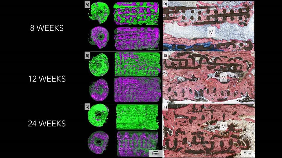 bone growth