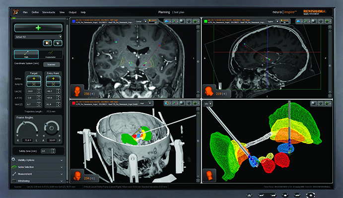 Neuromate software