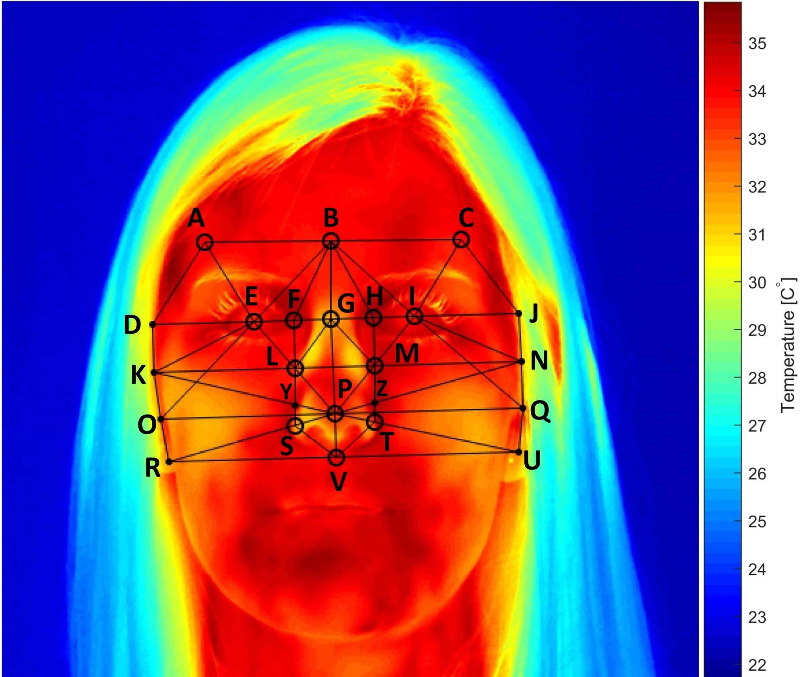 Thermal