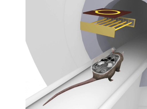 MRI coil