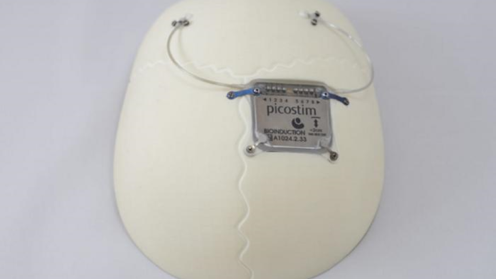 he Picostim-DyNeuMo research system, made by UK company Amber Therapeutics, is an adaptive neurostimulator seated in the skull with two electrodes placed in targeted brain circuits to sense physiological signals and provide stimulation