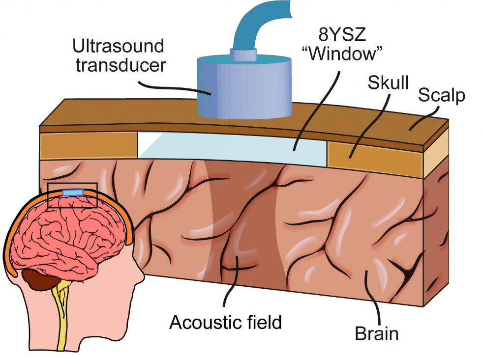 Ceramic cranial implant gives ultrasound access to brain (UC Riverside)