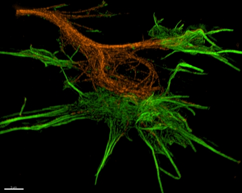 neurons, brain