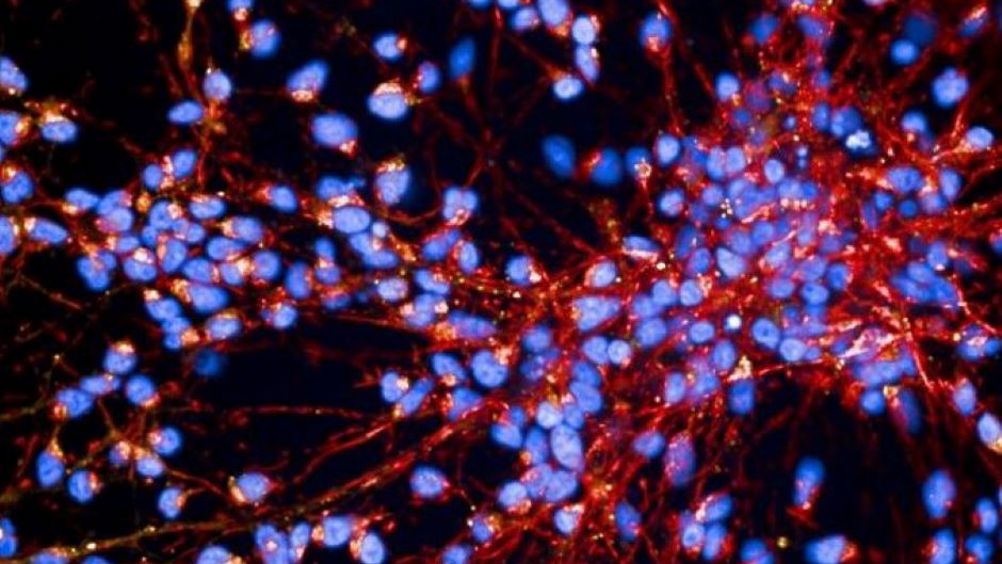 Nerve cells in the cortex of the brain generated from patients' stem cells - the type of image the computer model used