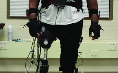 Huang’s work focuses on technology that translates electrical signals in human muscle into signals that control powered prosthetic limbs